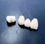 ハイブリッドセラミックの画像